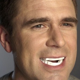 Man wearing oral appliance for sleep apnea treatment